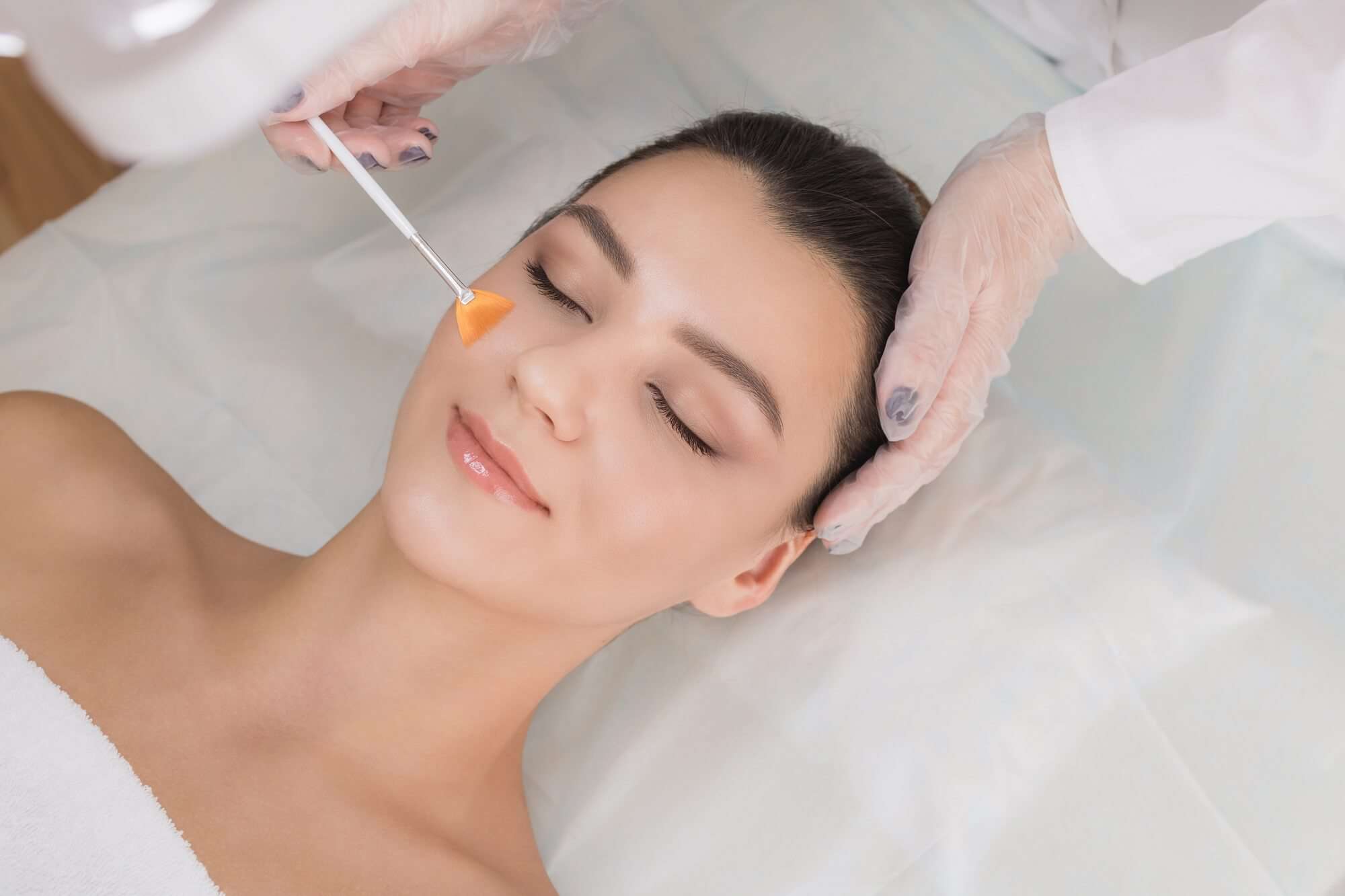 Young Woman Getting Chemical Peel Treatment | True Beauty Forever in in Kaysville, UT