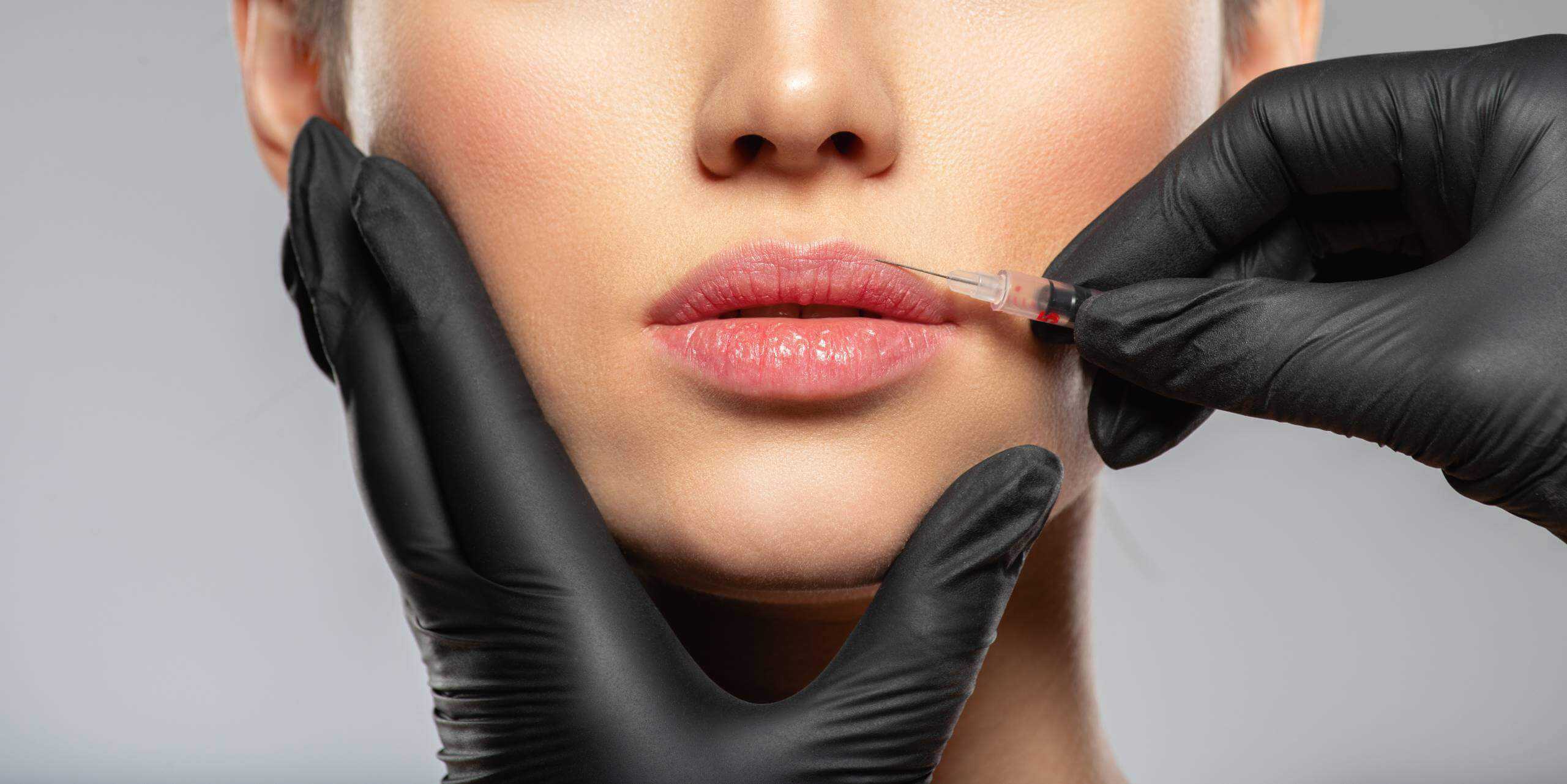 Lip Filler Injections By True Beauty Forever