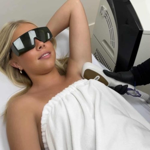 laser hair removal Layton