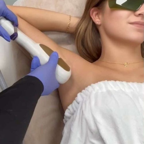 laser hair removal Bountiful