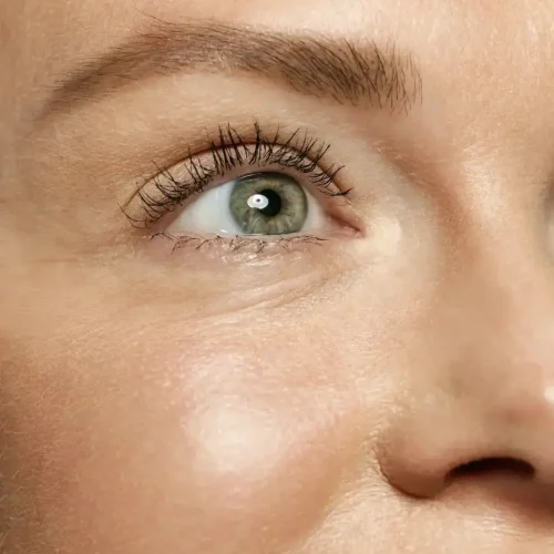 Opus-Plasma-at-TrueBeauty-Forever-in-Kaysville-UT