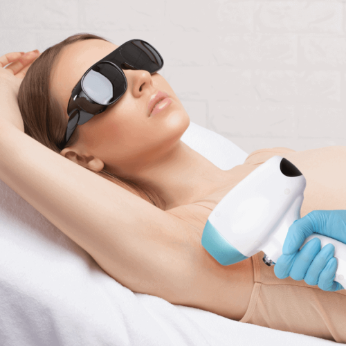 A Woman getting laser hair removal treatment on Underarms | Laser Hair Removal In Kaysville, UT | True Beauty Forever