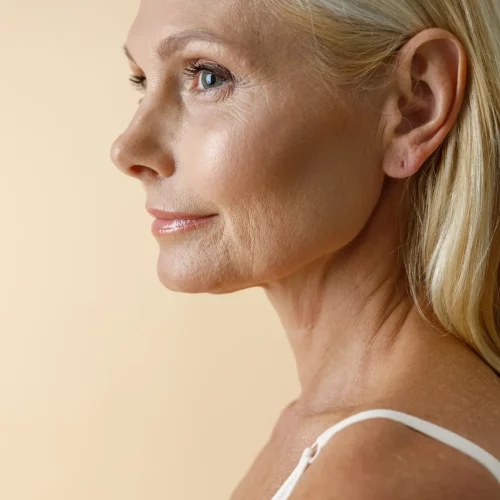 Dermal filler-truebeauty forever-in-kaysville-UT