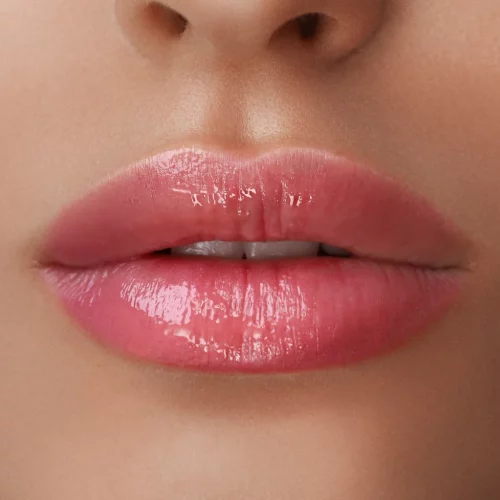 lip filler-truebeauty forever-in-kaysville-UT