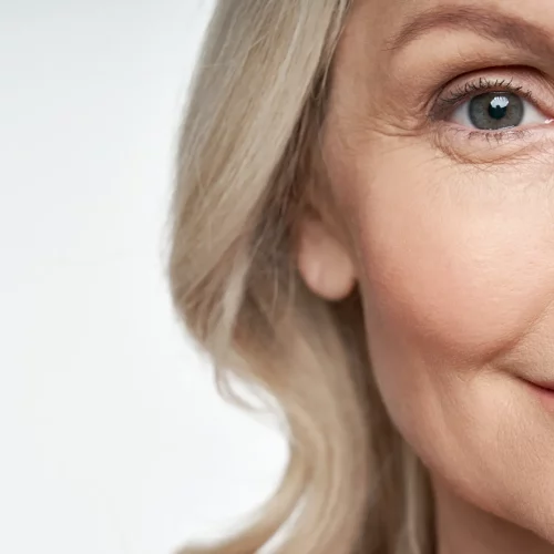 Microneedling-truebeauty forever-in-kaysville-UT