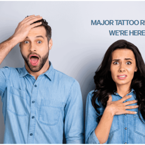 Couples with shocked expressions | Laser Tattoo Removal In Kaysville, UT | True Beauty Forever